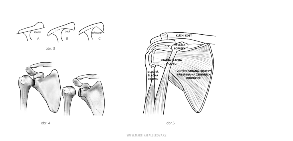 Bolest ramene - martinafallerova.cz