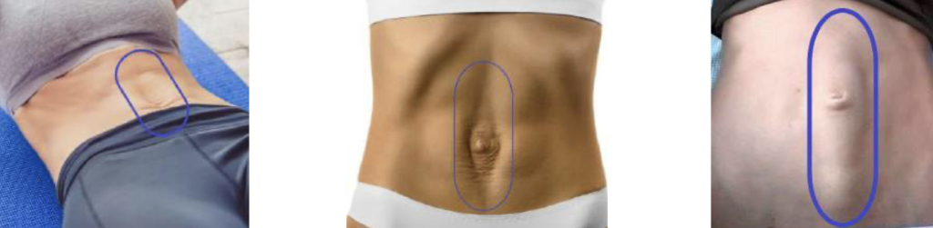 Diastáza - jak otestovat - martinafallerova.cz