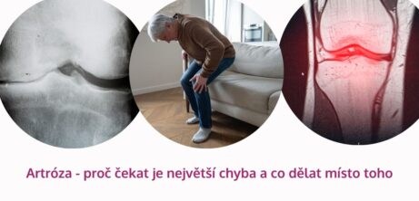 Artróza: proč čekat je největší chyba a co dělat místo toho - martinafallerova.cz