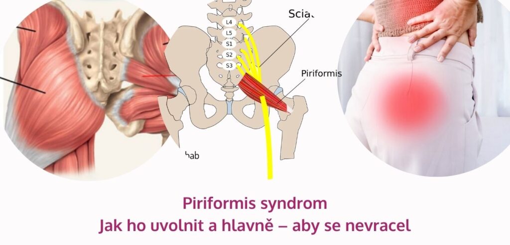 Piriformis syndrom: jak ho uvolnit a hlavně – aby se nevracel - martinafallerova.cz