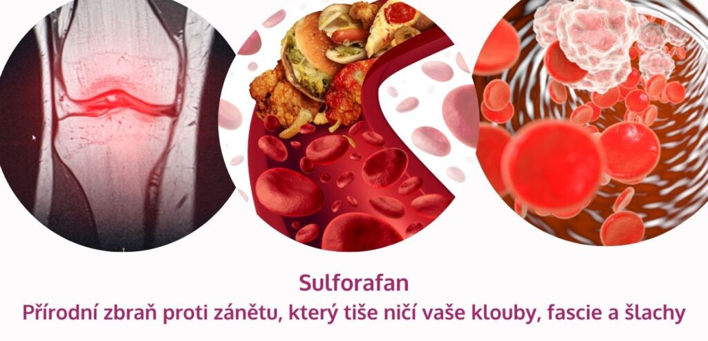 Sulforafan: přírodní zbraň proti zánětu, který tiše ničí vaše klouby, fascie a šlachy - martinafallerova.cz