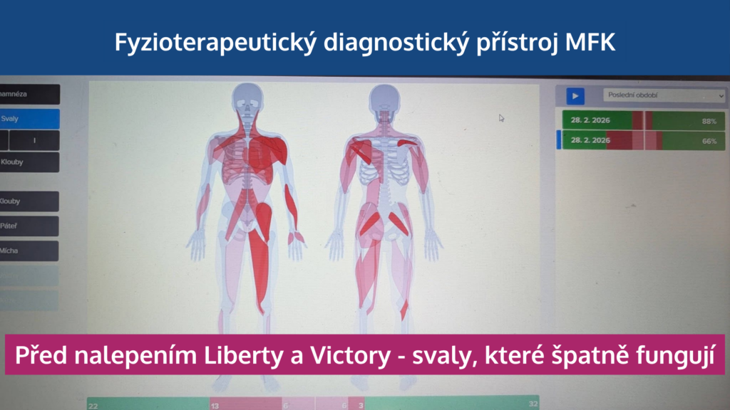 Jak neuronáplasti Super Patch zapojují svaly, odlehčují páteři a zlepšují výkon - martinafallerova.cz