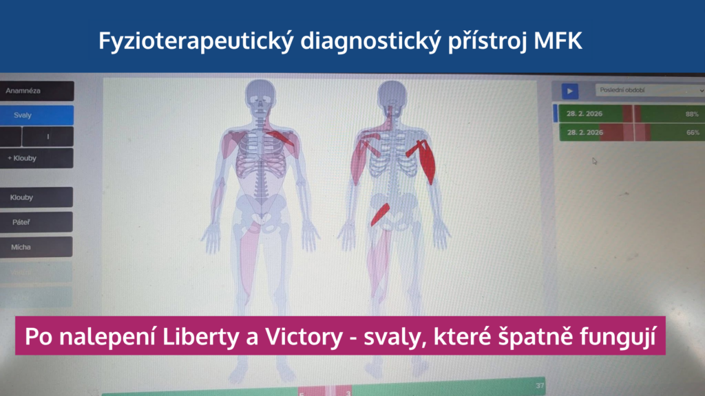 Jak neuronáplasti Super Patch zapojují svaly, odlehčují páteři a zlepšují výkon - martinafallerova.cz