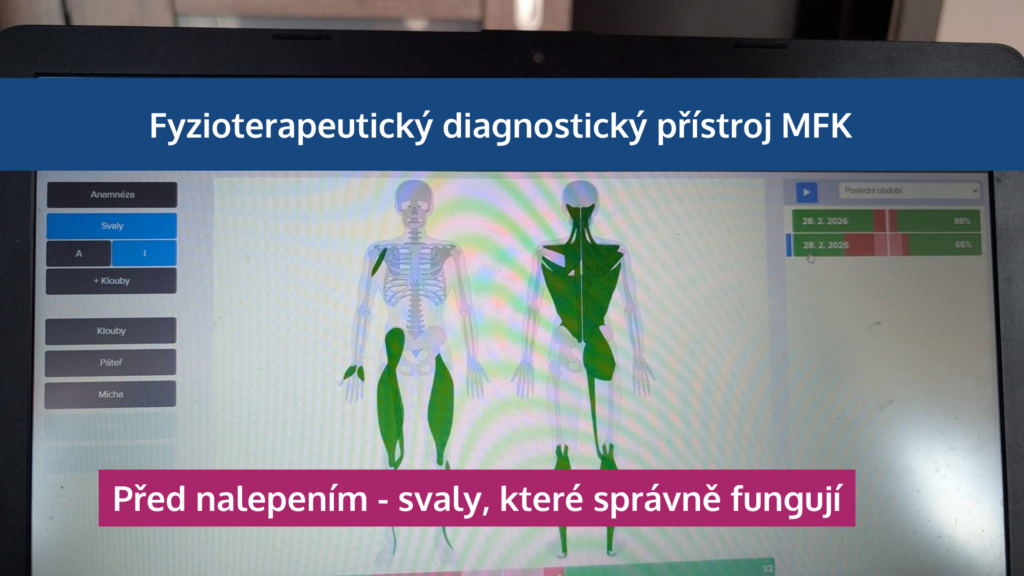Jak neuronáplasti Super Patch zapojují svaly, odlehčují páteři a zlepšují výkon - martinafallerova.cz