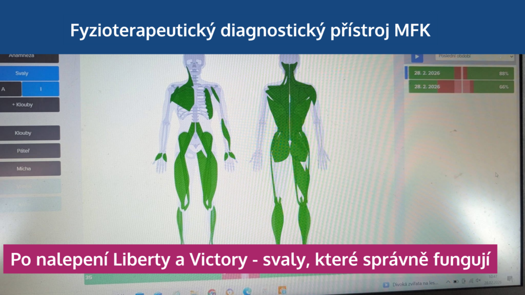 Jak neuronáplasti Super Patch zapojují svaly, odlehčují páteři a zlepšují výkon - martinafallerova.cz