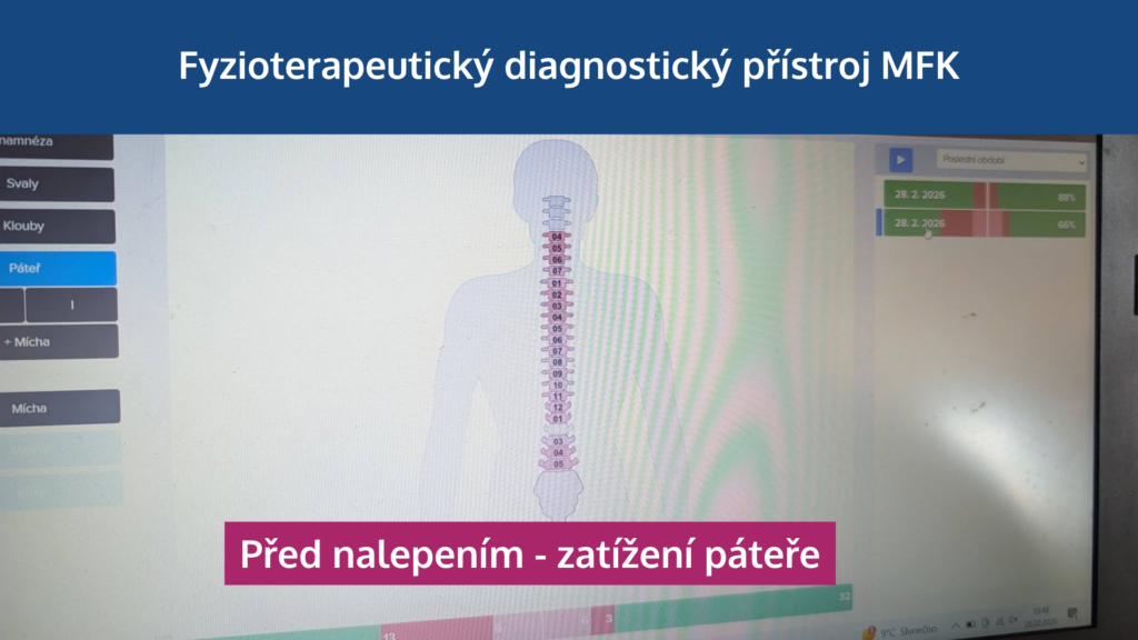Jak neuronáplasti Super Patch zapojují svaly, odlehčují páteři a zlepšují výkon - martinafallerova.cz