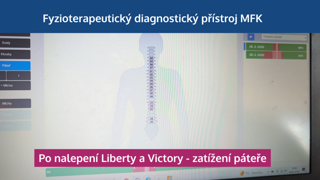 Jak neuronáplasti Super Patch zapojují svaly, odlehčují páteři a zlepšují výkon - martinafallerova.cz