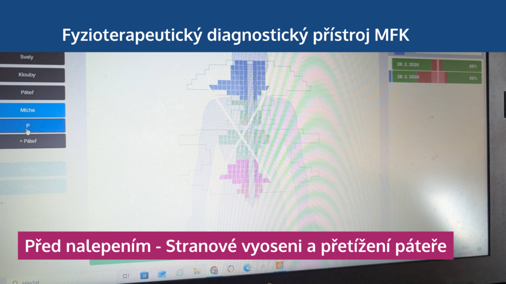 Jak neuronáplasti Super Patch zapojují svaly, odlehčují páteři a zlepšují výkon - martinafallerova.cz