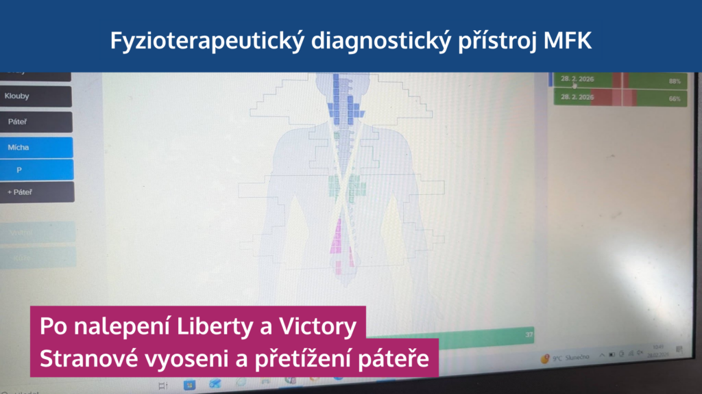 Jak neuronáplasti Super Patch zapojují svaly, odlehčují páteři a zlepšují výkon - martinafallerova.cz